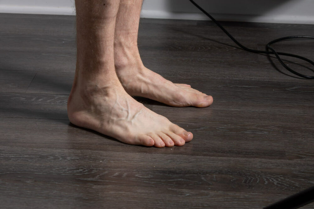 Hands and Feet - Reference Pictures